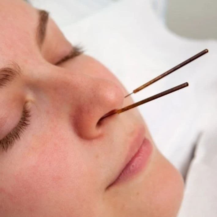 Réflexologie Endonasale